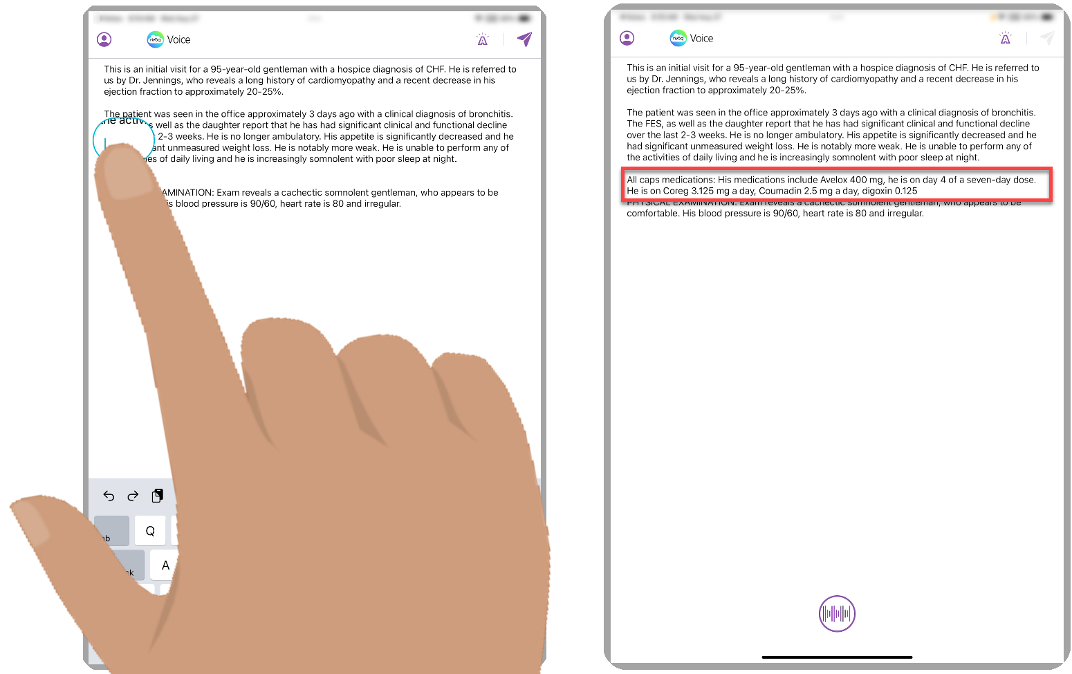 iOSMV-dictation-screen-place-cursor-and-dictate-2020.png