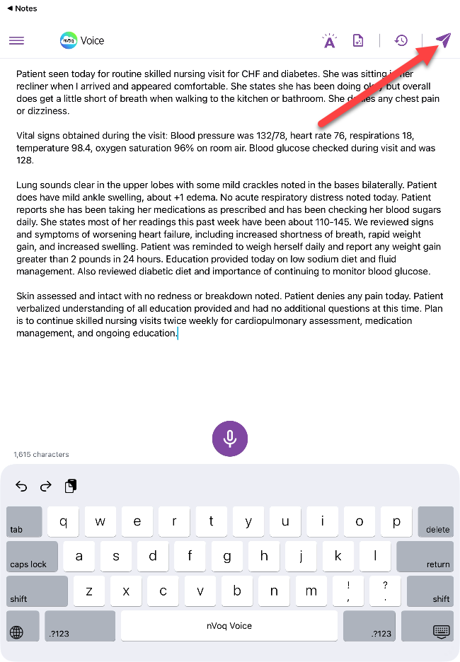 voice-iOS-NoteCompose-Send-ipad.png