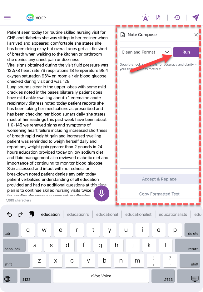 voice-iOS-NoteCompose-tap-Run-ipad.png