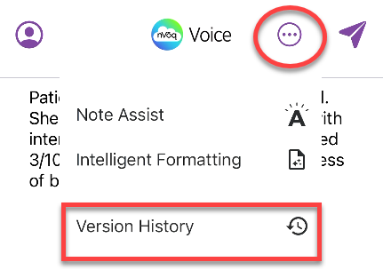 voice-iOS-VersionHistory-menu-iPhone.png