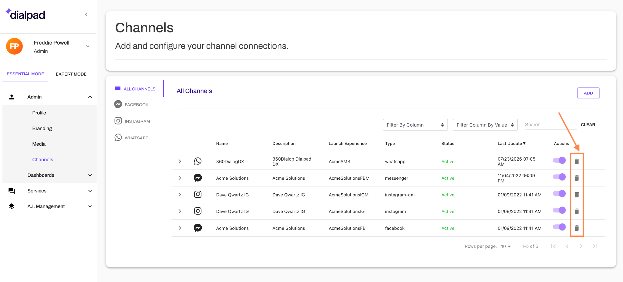 Dialpad interface showing channel configurations with options to delete digital channels